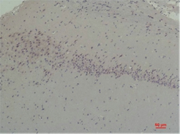 CABP2 Polyclonal Antibody