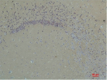 Glutamate Receptor 1 Polyclonal Antibody