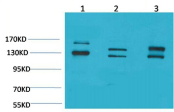 BAI1 Polyclonal Antibody