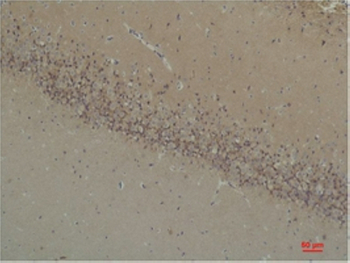 BAI1 Polyclonal Antibody
