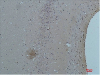 ASIC1 Polyclonal Antibody