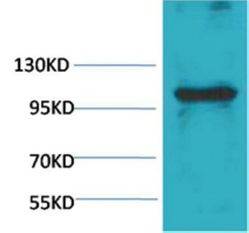 eEF1A2 binding protein Polyclonal Antibody
