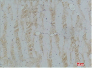 eEF1A2 binding protein Polyclonal Antibody