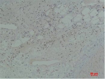 STAT5b Polyclonal Antibody