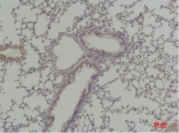 Cyclin D1 Polyclonal Antibody
