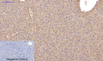 Active Caspase-3 Monoclonal Antibody(5E1)