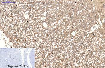 MICU1 Monoclonal Antibody(Mix)