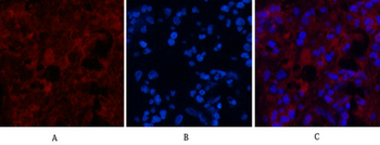 MICU1 Monoclonal Antibody(Mix)