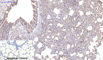 p70 S6 kinase α Polyclonal Antibody