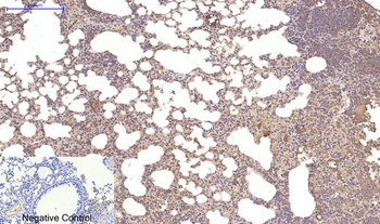 p70 S6 kinase α Polyclonal Antibody