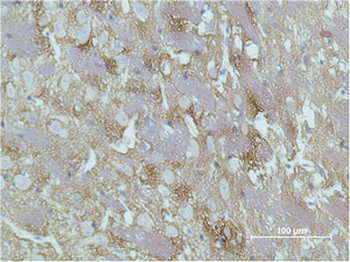 GAP-43 Monoclonal Antibody(Mix)