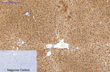 HAO1 Monoclonal Antibody(Mix)