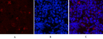 HAO1 Monoclonal Antibody(Mix)