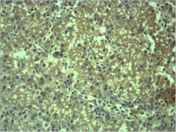 EPG5 Polyclonal Antibody