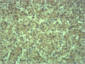 EPG5 Polyclonal Antibody