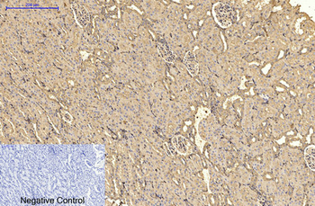 α-SMA Monoclonal Antibody(6A12)