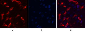 α-SMA Monoclonal Antibody(6A12)
