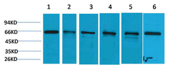 AMPKα1 Polyclonal Antibody