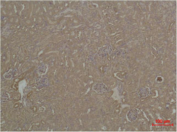 HSC 70 Polyclonal Antibody