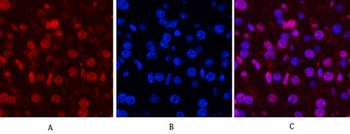 PR Monoclonal Antibody(Z15)