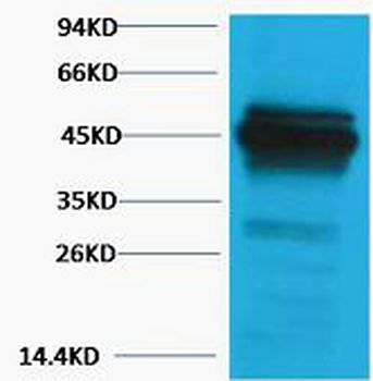 CK18 Polyclonal Antibody