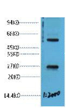 EFHD1 Polyclonal Antibody