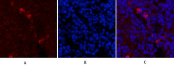 Fibronectin Monoclonal Antibody(M9)