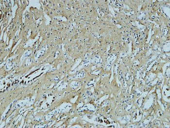 Fibronectin Monoclonal Antibody(M9)