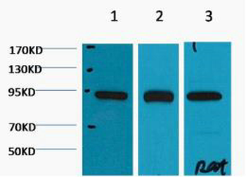 HSP90β Monoclonal Antibody(M2)