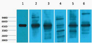 Cytokeratin 18 Monoclonal Antibody(8F2)