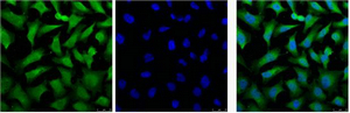 Cytokeratin 18 Monoclonal Antibody(1B3)