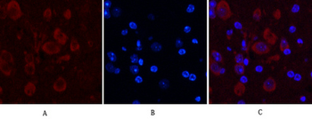 Caspase 9 Monoclonal Antibody(3-20)