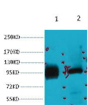 ABCB5 Monoclonal Antibody(11A2)