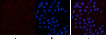 CD10 Monoclonal Antibody(5B8)