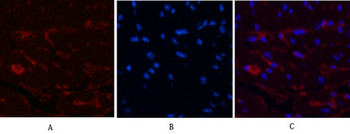 CD1 Monoclonal Antibody(9H6)