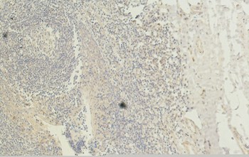 CD1 Monoclonal Antibody(9H6)