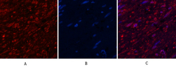 Aquaporin 4 Monoclonal Antibody(4H1)