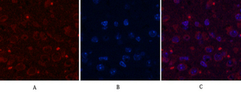 Aquaporin 4 Monoclonal Antibody(4H1)