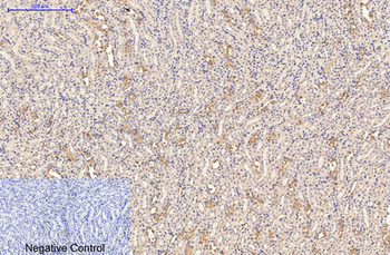 CD21 Monoclonal Antibody(2C5)