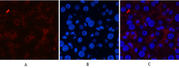 CD21 Monoclonal Antibody(2C5)