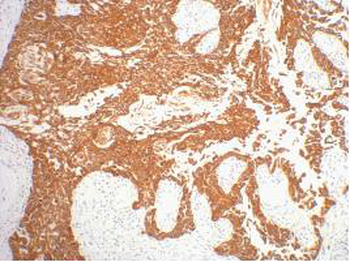 CK16 Monoclonal Antibody(6F6)