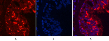 CD68 Monoclonal Antibody(6F3)