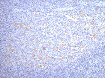 CD68 Monoclonal Antibody(6F3)