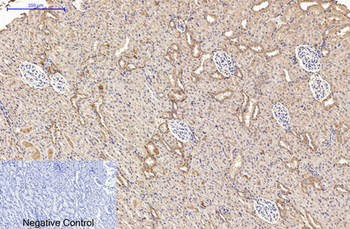 AMACR Monoclonal Antibody(4A12)
