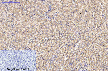 AMACR Monoclonal Antibody(4A12)
