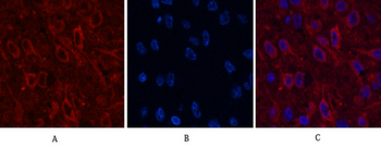 AMACR Monoclonal Antibody(4A12)