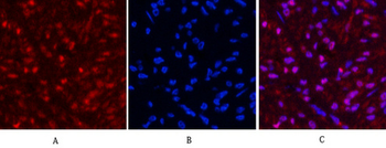 HSP70 Monoclonal Antibody(3G10)