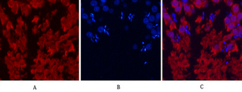 HSP70 Monoclonal Antibody(3G10)