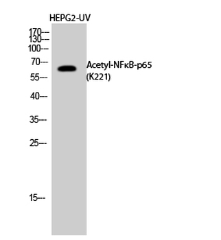 NFκB-p65 (Acetyl Lys221) Polyclonal Antibody