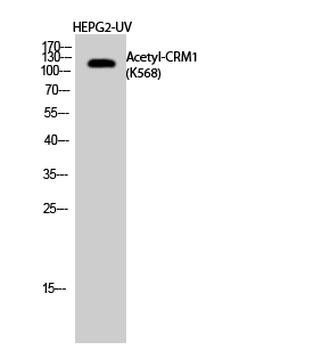 CRM1 (Acetyl Lys568) Polyclonal Antibody